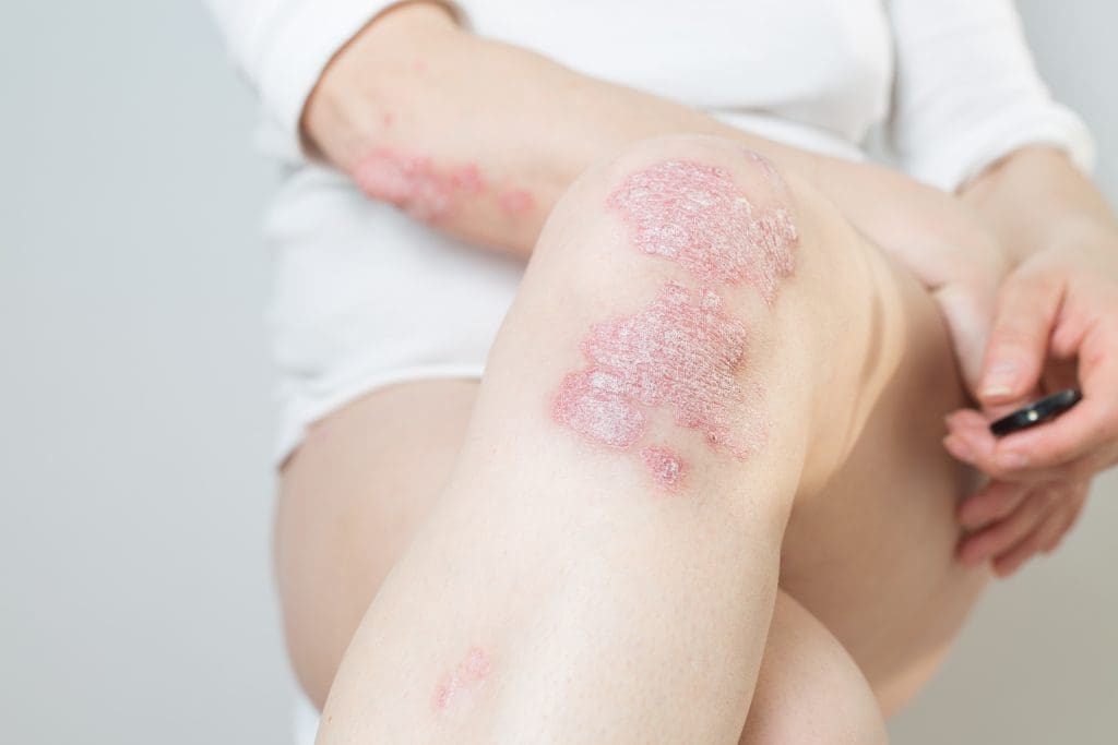 Autoimmune peptide consultation at PRANA Fortville