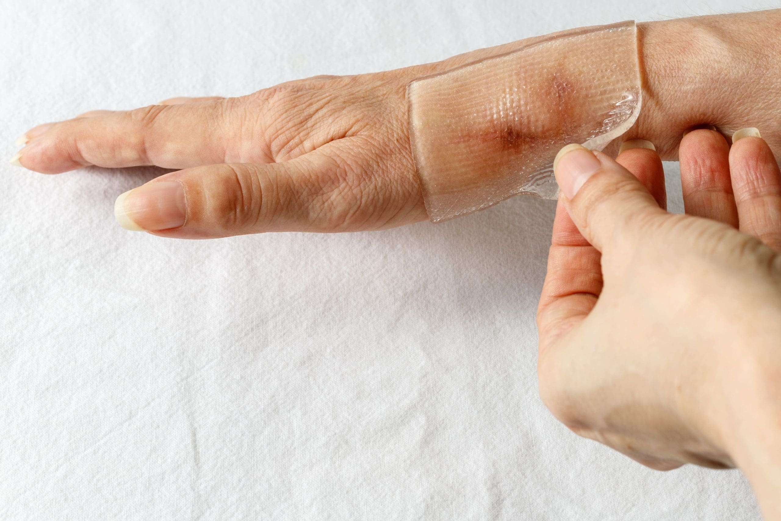Tissue healing consultation at PRANA clinic
