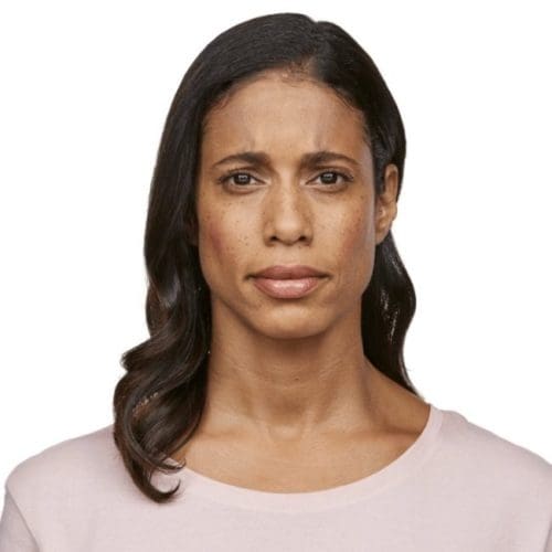 Jeuveau Before and After - Case -1, Image 2 - Female, age 45 – 54 - Fortville, IN - PRANA IV Hydration & Wellness Clinic
