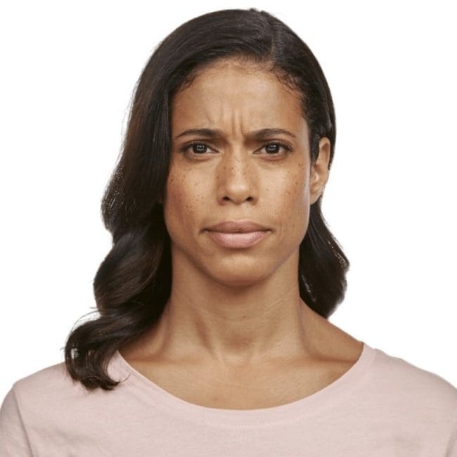Jeuveau Before and After - Case -1, Image 1 - Female, age 45 – 54 - Fortville, IN - PRANA IV Hydration & Wellness Clinic