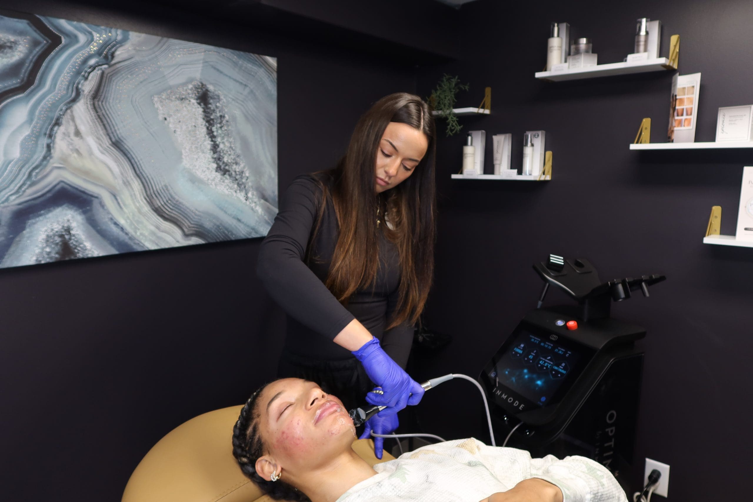 Forma RF skin tightening treatment at PRANA Fortville