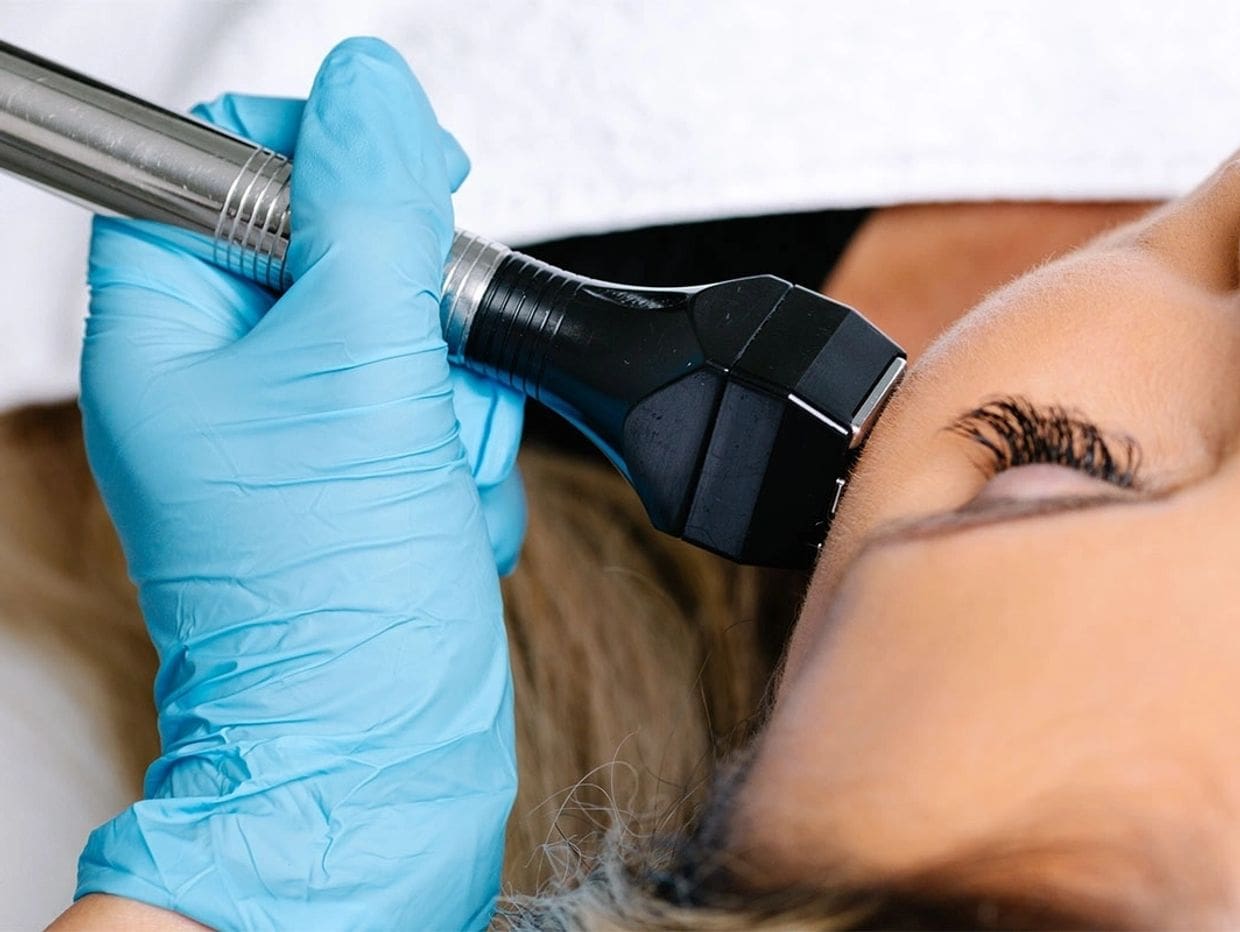 RF facial treatment at PRANA wellness clinic